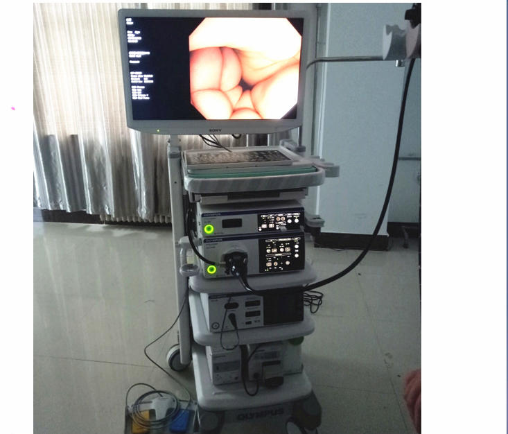 Vinmax Gastrointestinal endoscope CV170 image processing device LED cold light source electronic gastroscope GIF-H170 digestion