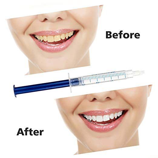 Dental Bleaching Teeth Whitening System Oral Gel Kit